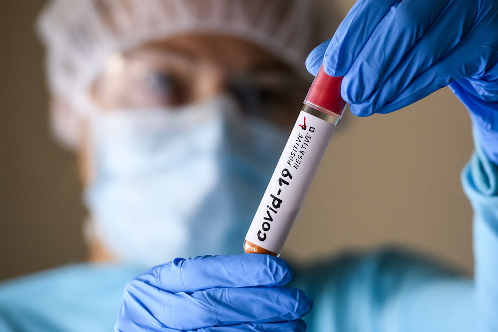 Woman in protective suit hold test tube with positive result infected with coronavirus COVID - 19. Photo Illustration.